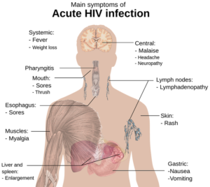 Symptoms of HIV Infection (2)