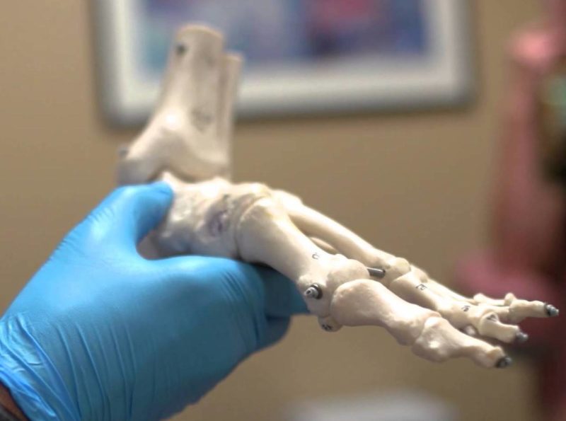 ankle bones