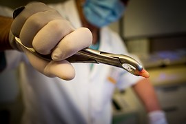 dentist doing an operation