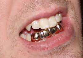 teeth crowns